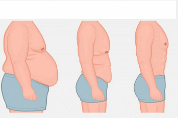  چگونه چربی شکم را بدون جراحی از بین ببریم؟